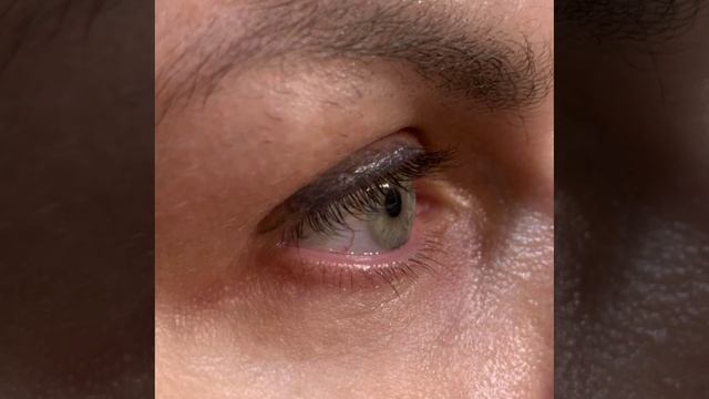 -2308772662805057731