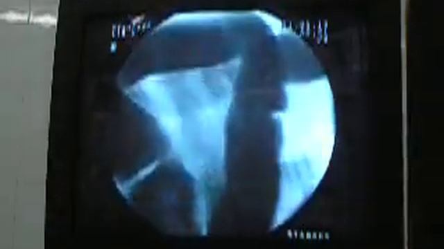 Colon por enema смотреть онлайн