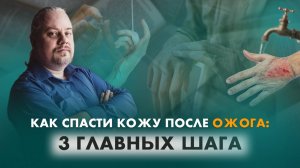Как спасти кожу после ожога: 3 главных шага | Дмитрий Попов | Гомеопатия и психотерапия