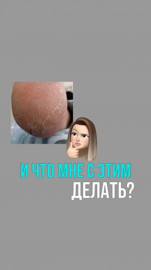 Сухие пятки
