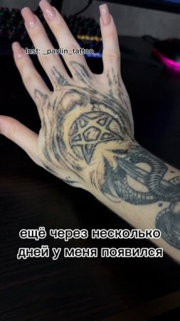 Сведение татуировки | удаление тату
