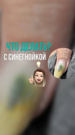 Плесень на ногтях ?!?!