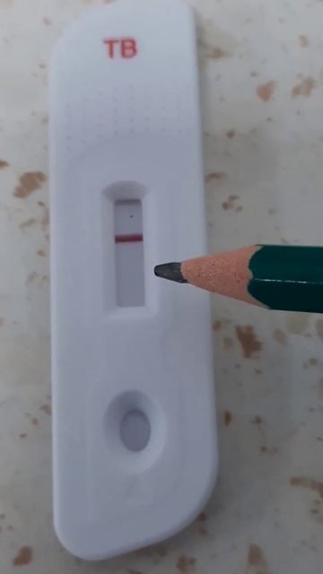 Tuberculosis (TB) test for detection of Mycobacterium tuberculosis antibody shows negative reaction смотреть онлайн