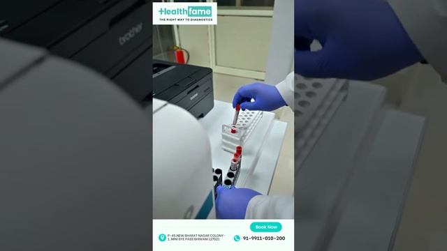 Automated Equipment's # Pathology Lab #Startup # Blood Test # sample Processing