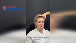 Эндоскопия лба разметка