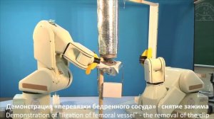 Роботизированная операция: ампутация нижней конечности на уровне бедра