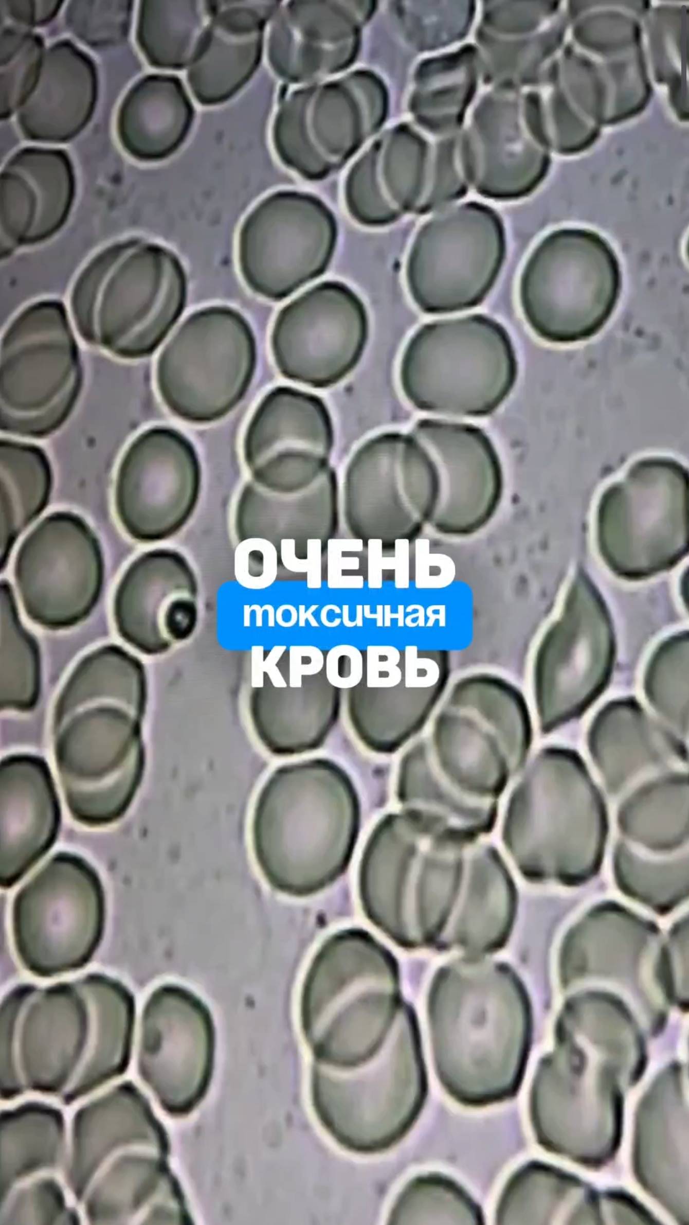 Токсичная кровь. Откуда бактерии в крови? Алена Братишко