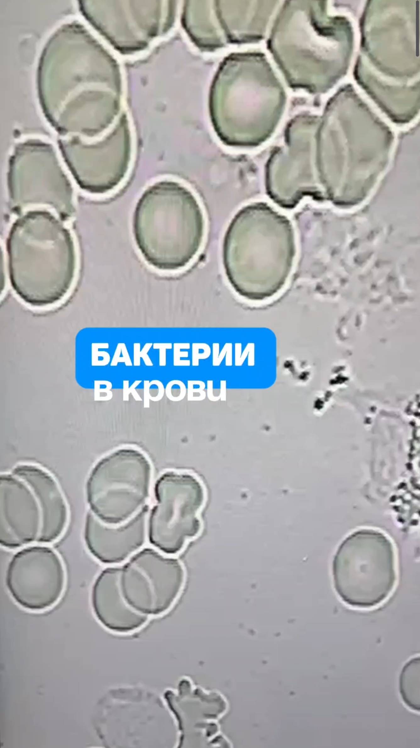 Бактерии в крови