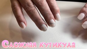 Восстановление сложных ногтей