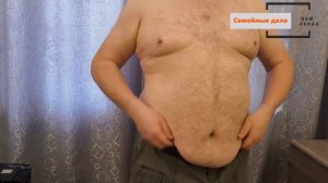 Мой живот после интервального голодания. Показывай свой живот.2.0