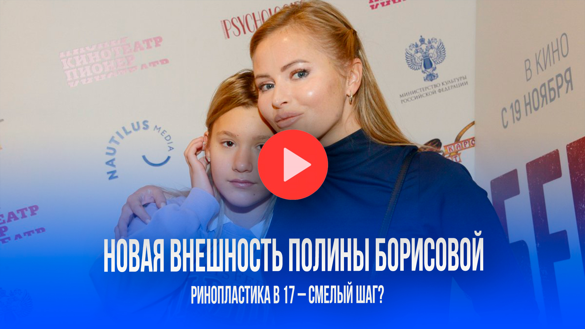 Секрет преображения: дочь Борисовой в 17 лет решилась на ринопластику – вот что получилось