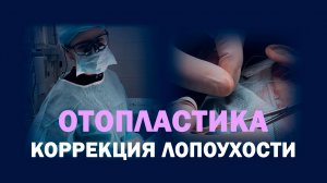 Отопластика: коррекция ушных раковин: операция и результат через 3 месяца