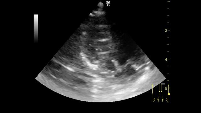 сердце малыша смотреть онлайн