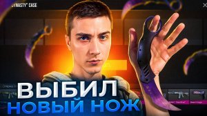 ОТКРЫЛ БОЛЕЕ 50 НОВЫХ КЕЙСОВ DYNASTY И ВЫБИЛ НОЖ В STANDOFF 2