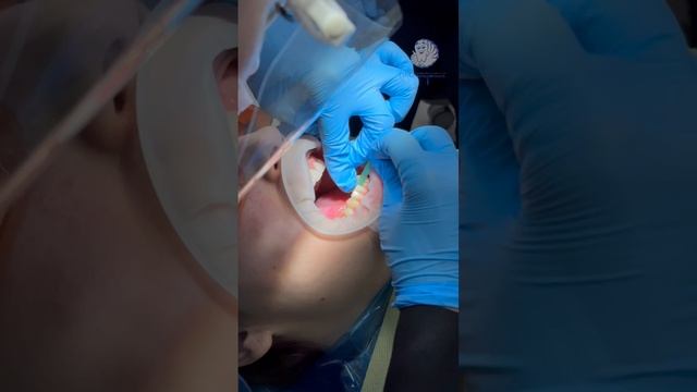 Процесс работы🦷
Стоматология «Жемчужина» Мурманск