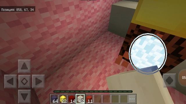 Моя первая операция смотреть онлайн