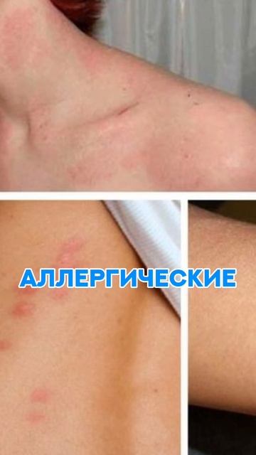 КОГДА ПИТЬ ВИТАМИНЫ? #витамины #рецепт #зож #похудение #пп #нутрициолог #стресс #потерявеса #шортс