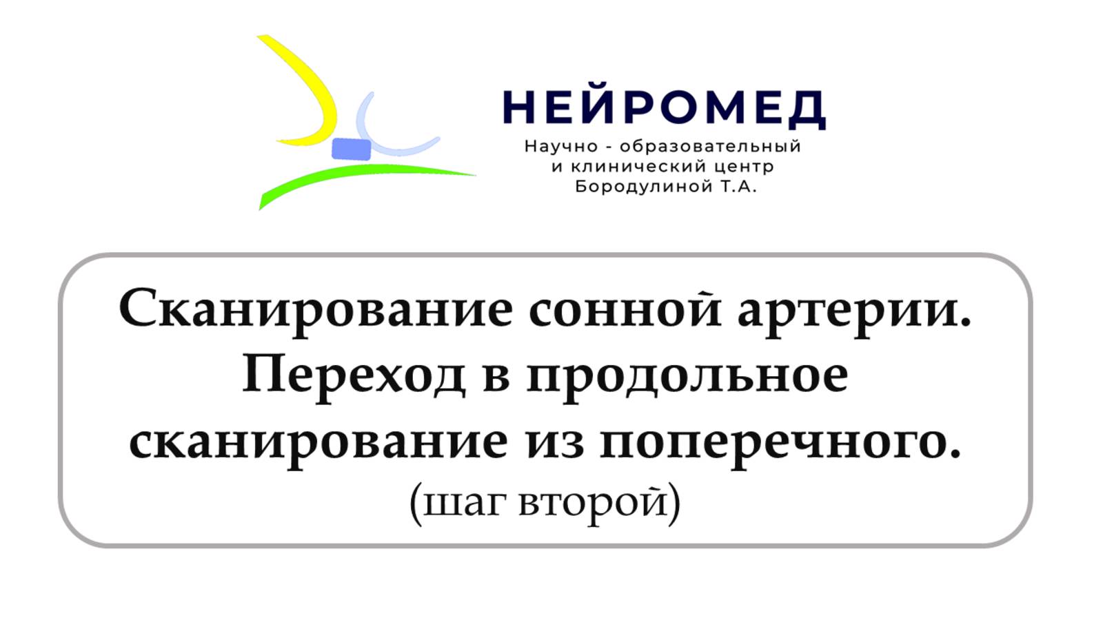 Сканирование сонной артерии. Переход в продольное сканирование из поперечного (Шаг 2)