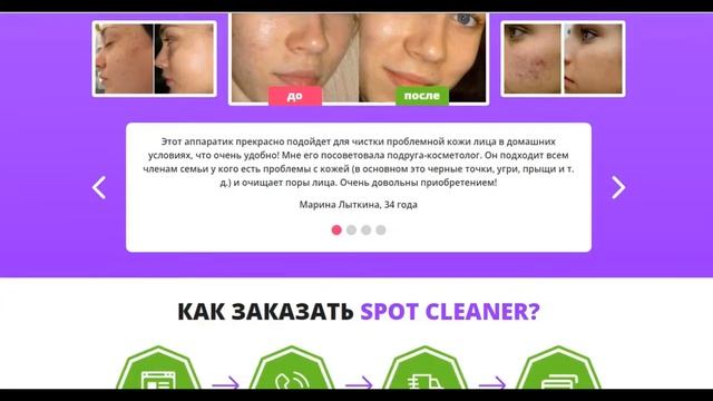 Очиститель пор для лица - Spot Cleaner смотреть онлайн