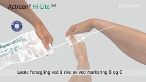 Actreen Hi-Lite katetersett