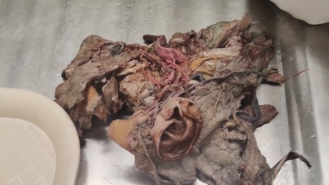 morfo 2 - anatomía - semana 9 - parte 2 смотреть онлайн