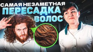 Можно ли пересадить волосы не сбривая их