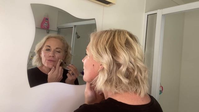 Hyaron skin booster | Mesotherapy, using the BAP technique.