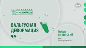 Вальгус или шишки на ногах. Что такое вальгусная деформация_ Лечение и диагностика _ Павел Липинский