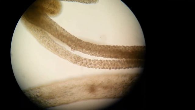 Hydra and its parasite Trichodina Part 2