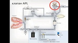 Устройство наркозного аппарата