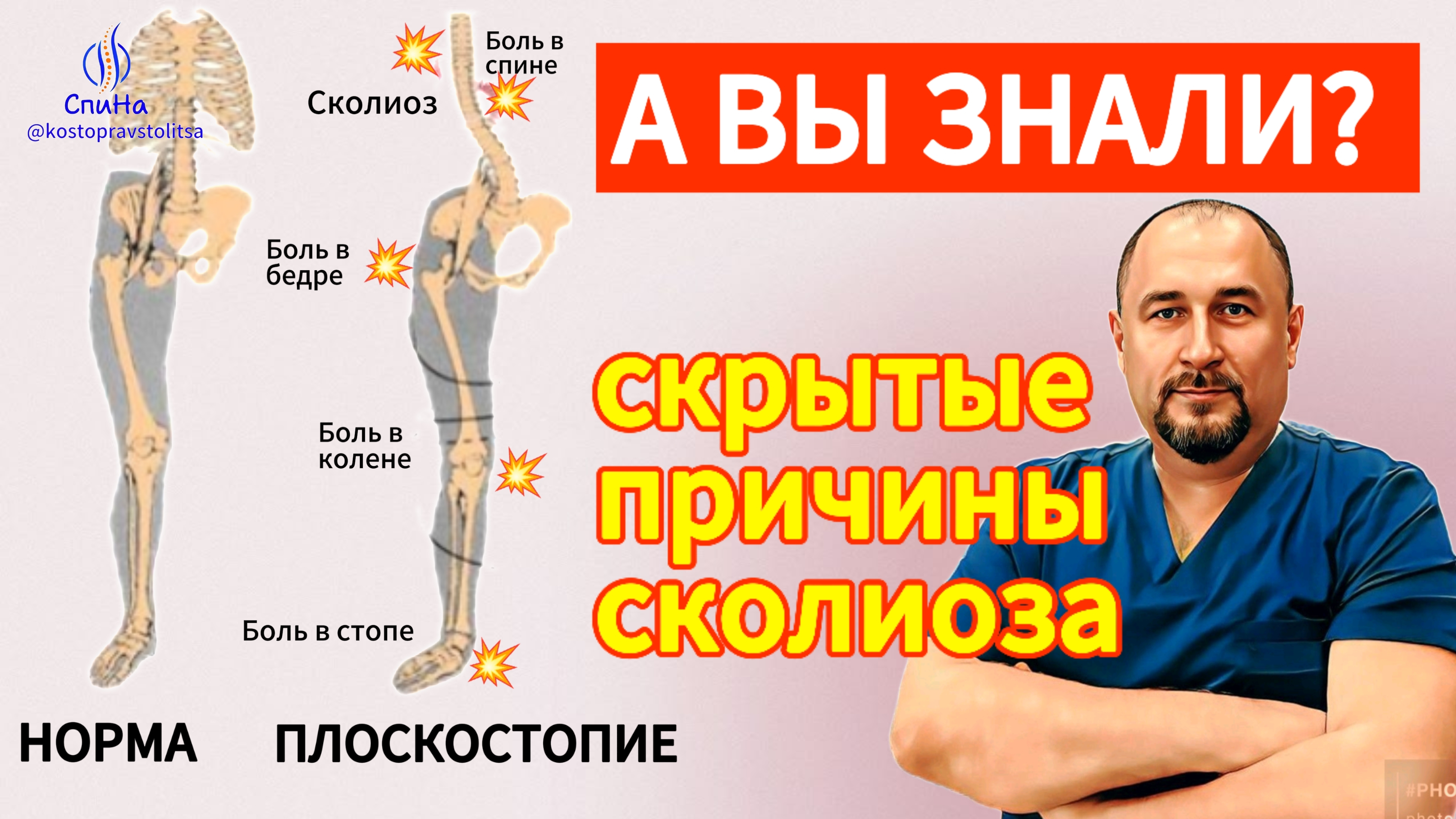 Скрытые причины сколиоза #костоправмосква #здоровьеспины #каклечить #чтоделать #правка #сколиоз