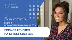 Пример лечения на брекет-системе