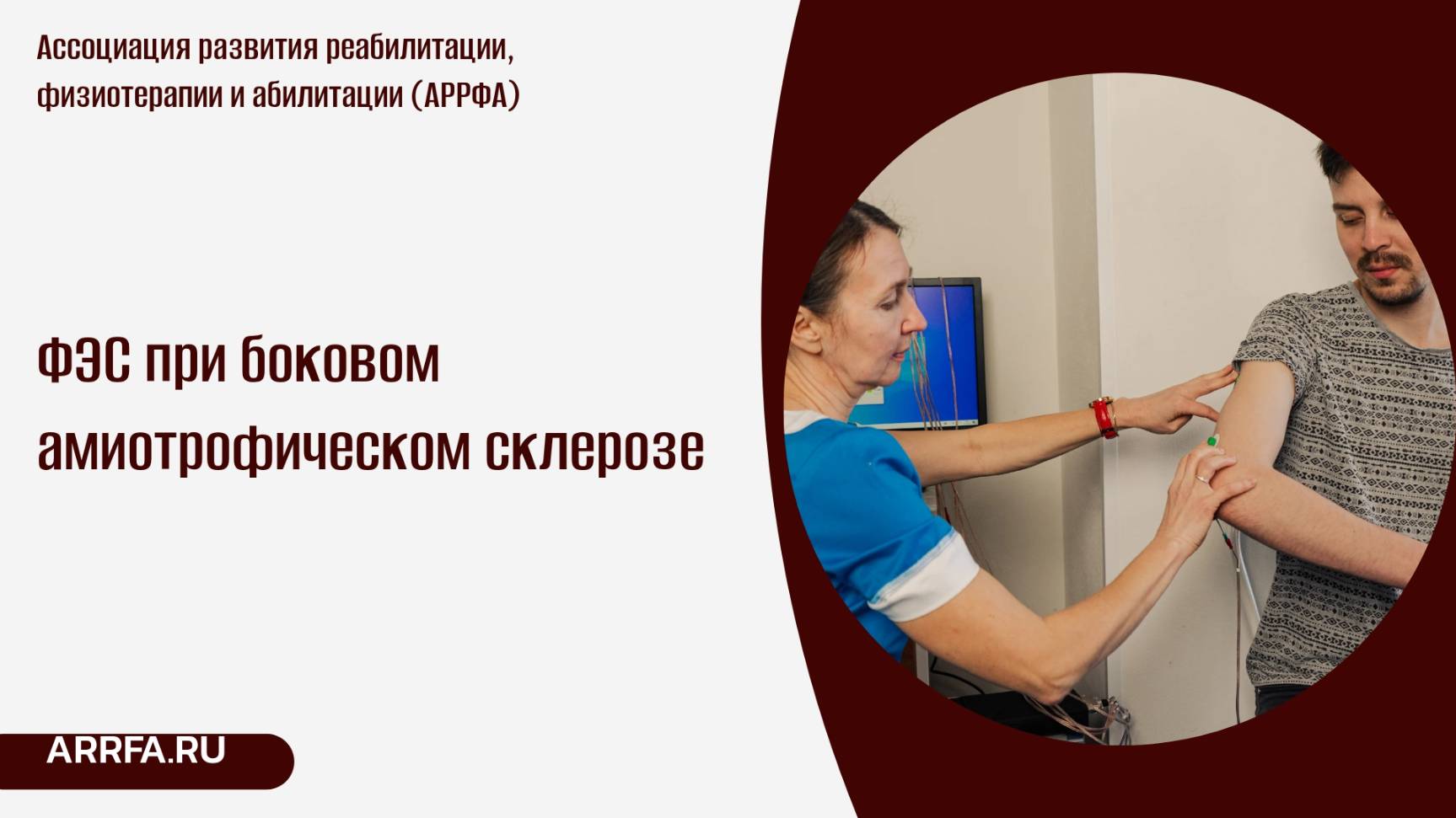 Функциональная электромиостимуляция при боковом амиотрофическом склерозе БАС