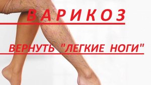 ВАРИКОЗ. КЛАПАННАЯ НЕСОСТОЯТЕЛЬНОСТЬ. ТЯЖЕСТЬ В НОГАХ. ЛЕЧАТ НЕ ТОЛЬКО ТАБЛЕТКИ.
