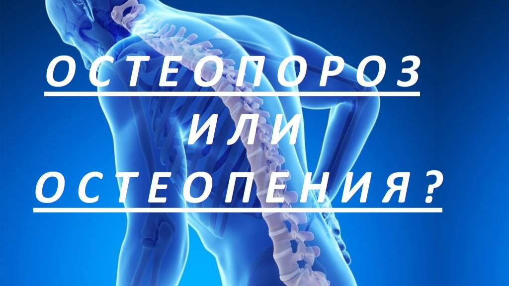 ОСТЕОПОРОЗ  или  ОСТЕОПЕНИЯ ? смотреть онлайн