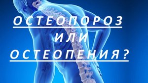 ОСТЕОПОРОЗ  или  ОСТЕОПЕНИЯ ?