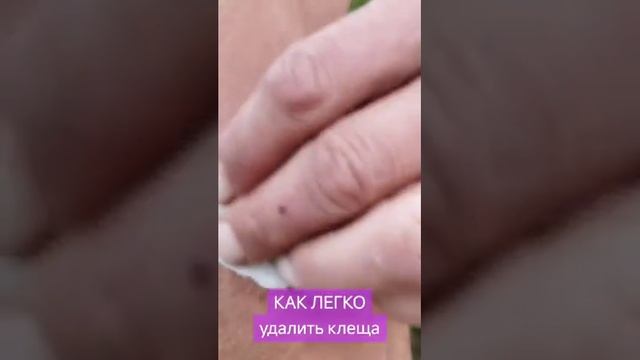 Как удалить клеща?