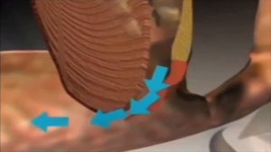 Клипса от храпа nose clip - легко и просто