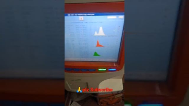 HIV HBsAg HCV VDRL Test #labtech #labtechnician #laboratory #pathologylab #bloodtests