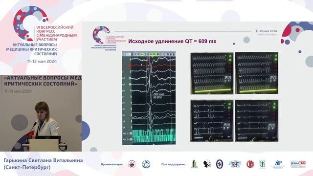 Медикаментозная кардиоверсии в ходе интервенционного лечения фибрилляции предсердий СПб 2024
