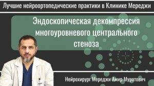 Эндоскопическая декомпрессия многоуровневого центрального стеноза.