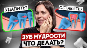 Зуб Мудрости: Удалять или нет?