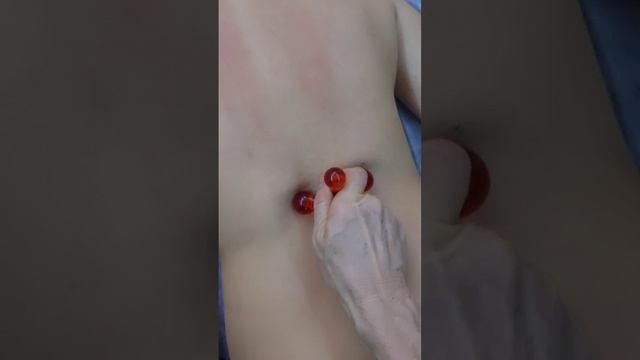 массаж паравертебральной зоны