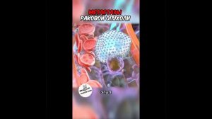 Раковая опухоль - процесс развития