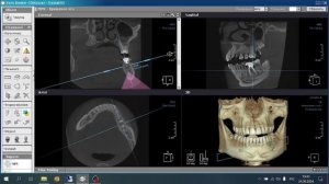 Рентгенодиагностика перед лечением