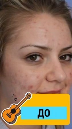 fotodinamika