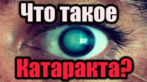 Что такое катаракта?Как лечить