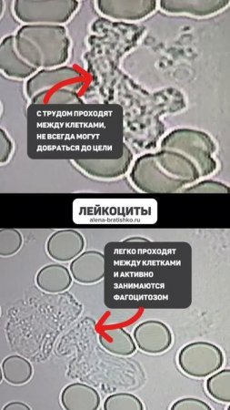 Нужно ли пить воду? Кровь под микроскопом. Алена Братишко