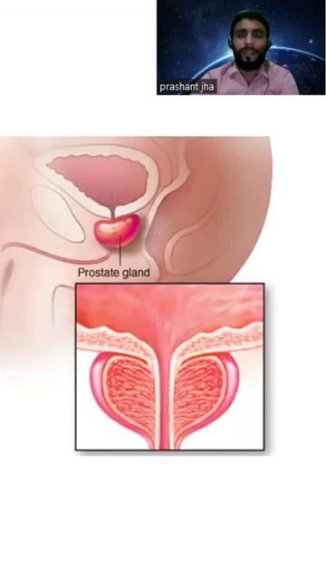 # Human Reproduction system #Male Representative System #Prostate gland