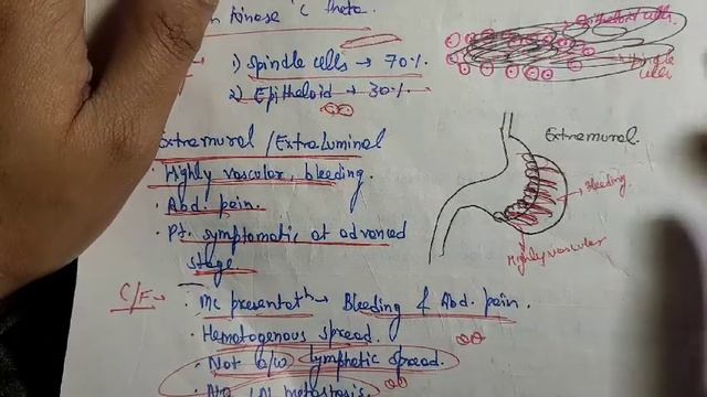 Gastrointestinal Stromal Tumor (GIST) Surgery